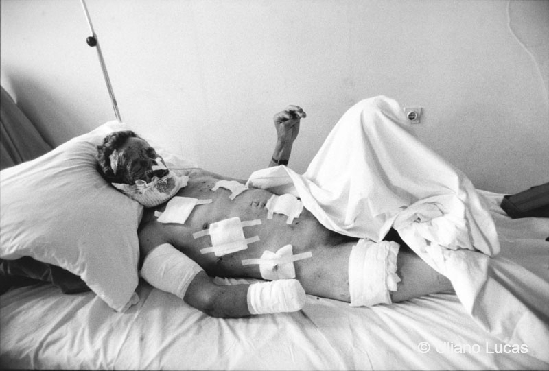 Ospedale militare, Sarajevo, 1993